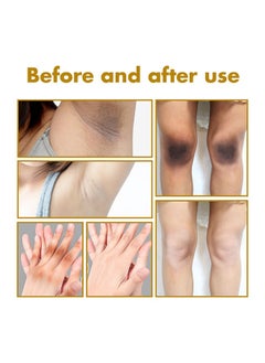 West&Month Peeling Plus-Acanthosis NigricansRremoval Oil,Dark Spot Corrector Oil, Acanthosis Nigricans Treatment For Dark Knuckle Finger Elbow And Knee Removal 50ML  - Image 3