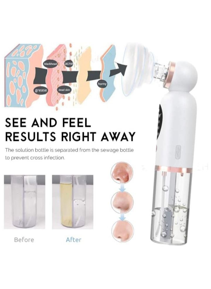 دي بلو مزيل الرؤوس السوداء ودورة المياه الكهربائية ، بثرة حب الشباب ، جهاز استخراج الرؤوس البيضاء الصغيرة ، منظف للوجه مزود بـ 3 قوة شفط للعناية بالبشرة - Image 4