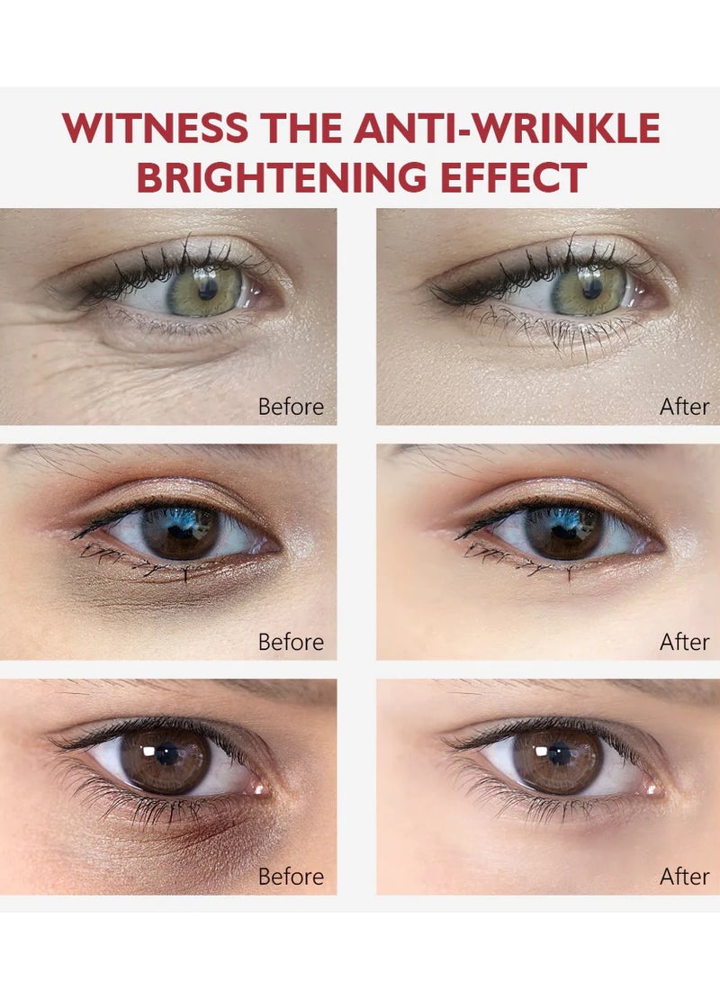 فايبرنت جلامور كريم ريتينول للعين، مضاد للشيخوخة، مضاد للانتفاخ، يحسن الهالات السوداء ويقلل الخطوط الدقيقة حول العينين 20 جرام - Image 2