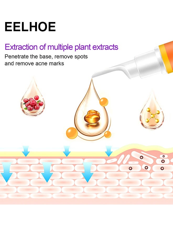 إيلهو تبييض النمش كريم VC تفتيح وتبييض البقع إزالة بقعة كريم إزالة القلم إزالة البقع والبقع الداكنة القلم تحسين لون البشرة تفتيح وتبييض البقع إزالة كريم - Image 3