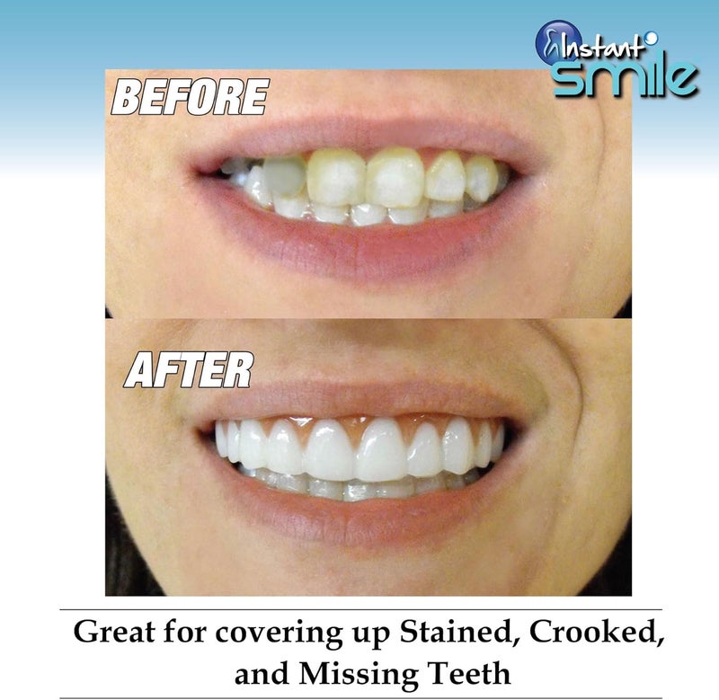 Instant Smile Comfort Fit Flex Cosmetic Upper Teeth Bright White Shade Comfortable Upper Veneer for Extended Wear Teeth Veneers for Men and Women 1 Size Fits Most - Image 4