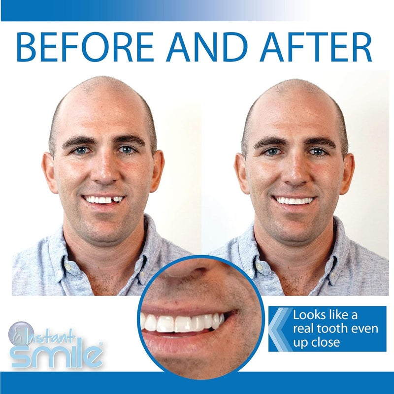 Instant Smile مجموعة الأسنان المؤقتة الابتسامة الفورية ProSeries - Image 3