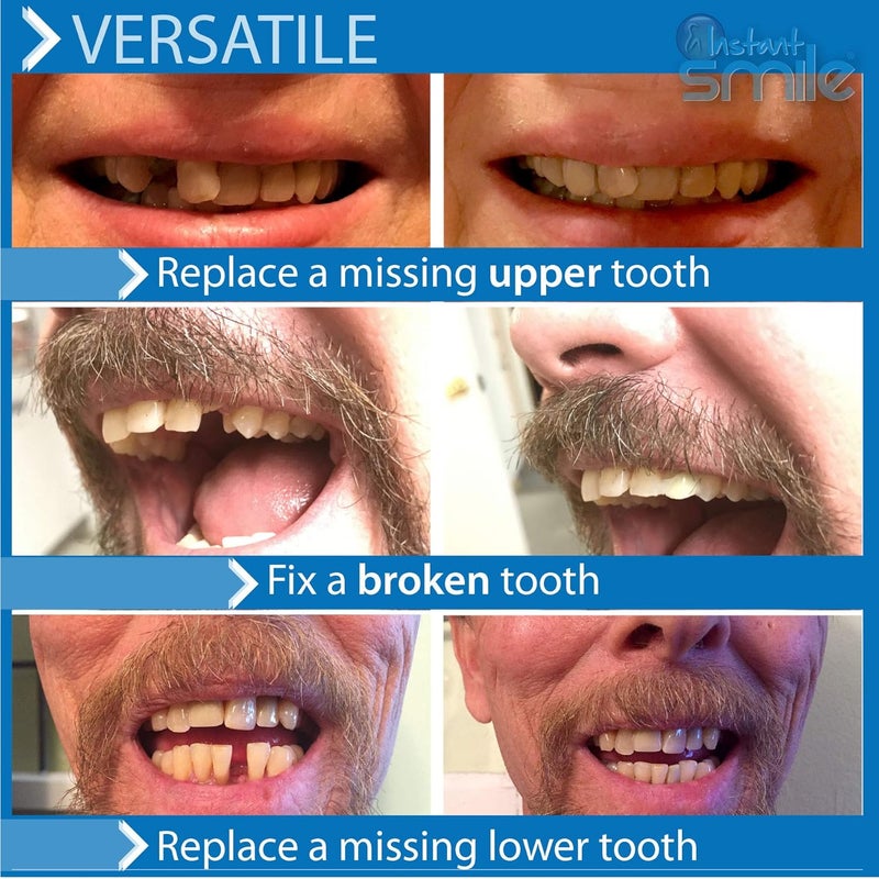 Instant Smile مجموعة الأسنان المؤقتة الابتسامة الفورية ProSeries - Image 4