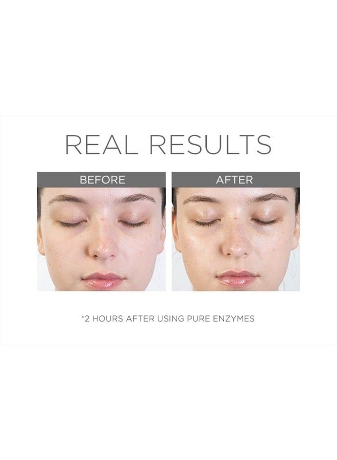 CosMedix Pure Enzymes Cranberry Exfoliating Mask, Gently Exfoliates Dry Skin, Helps Smooth Skin Texture, L-Lactic Acid & Cranberry Enzymes, Cruelty Free - Image 4