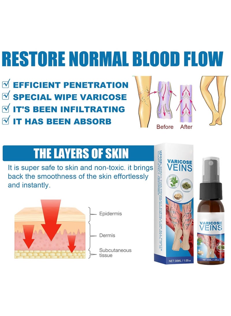 SOUTH MOON Varicose Treatment Spray 30ml, Varicose Veins Treatment Spray for Legs, Varicose Vein Remedies, Veinhealing Varicose Veins Treatment Spray  - Image 3