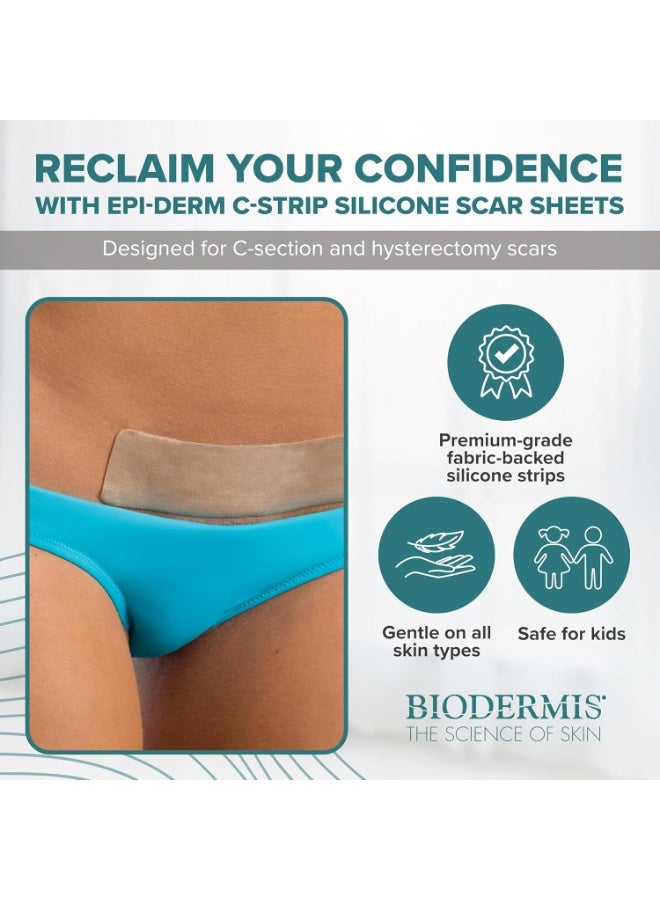 PROSIL EpiDerm (Natural) scar patch made of silicone 3.6x15cm self-adhesive on the whole body, for scar care after the operation and to remove old scars - Image 4