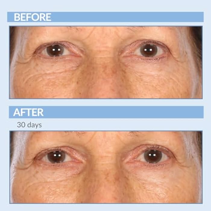 Serious Skincare Vitamin A Force XR Retinol Serum Concentrate - Micro Exfoliate & Resurface for Radiant Skin - For Lines, Wrinkles - Pore Minimizer - Encapsulated Retinol for Anti-Aging - Serious Skincare - 1 Oz. - Image 3