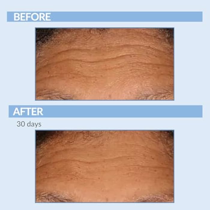 Serious Skincare Vitamin A Force XR Retinol Serum Concentrate - Micro Exfoliate & Resurface for Radiant Skin - For Lines, Wrinkles - Pore Minimizer - Encapsulated Retinol for Anti-Aging - Serious Skincare - 1 Oz. - Image 4