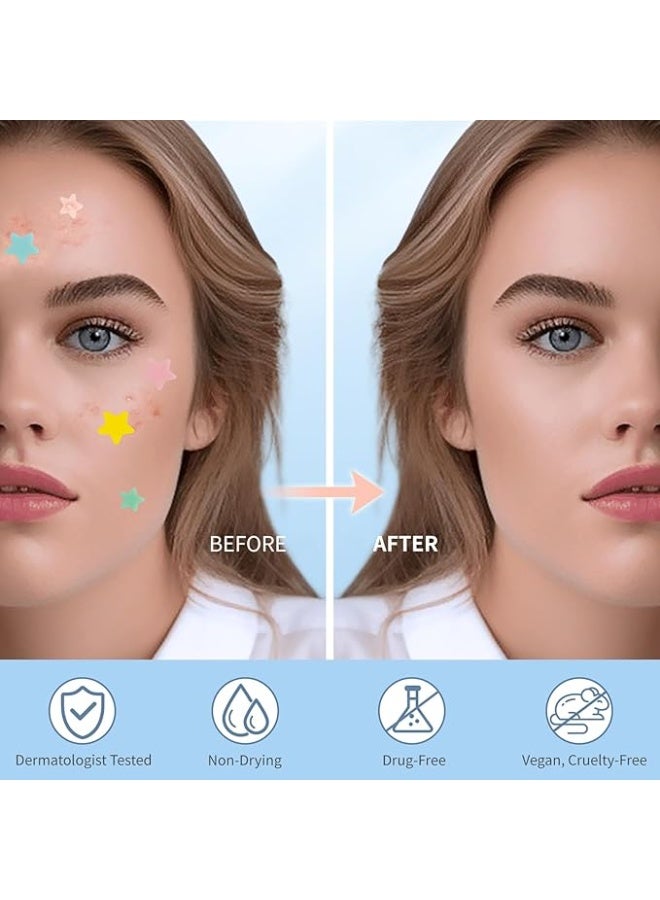 blue chic 200 Counts Star Shaped Acne Pimple Patch for Face Hydrocolloid Spot Stickers with Tea Tree and Salicylic Acid Colorful Pimple Covers in 5 Colors and 3 Sizes for All Skin Types - Image 4