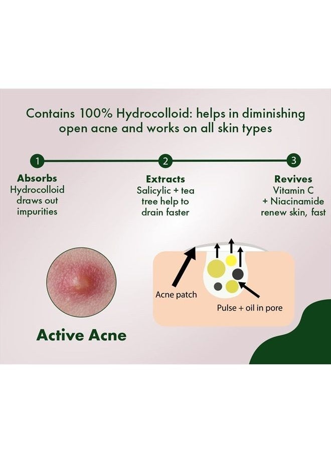 Urban yog - Acne Pimple Patch - Invisible Facial Stickers cover with 100% Hydrocolloid, Pimple Patches for Face (72 Dots) - Image 1