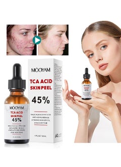 45% TCA Acid Skin Peel -  Malic Acid & Citric Acid, Anti-Aging, Reduce Acne and Dark Spots, Even Skin Tone, TCA 45% Skin Peel, 45% TCA Chemical Peeling Serum with Malic and Citric Acid for Dark Skin, Dark Spots and Acne Spots, Natural Skin Care - 30 ml/1 fl oz - pzsku/Z3FE7AD33495EEC7C8A80Z/45/_/1730863825/1e600943-a62b-4a81-ab32-8128050c7072