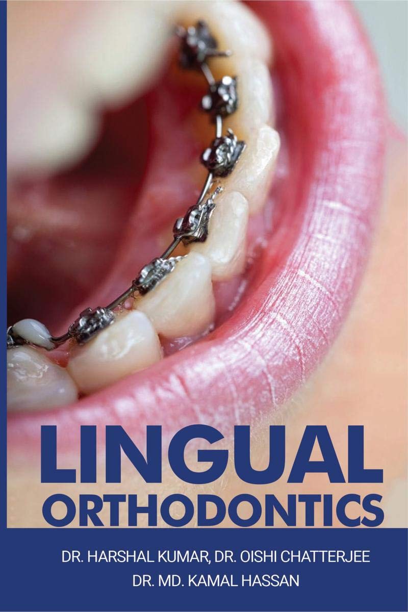 Lingual Orthodontics 