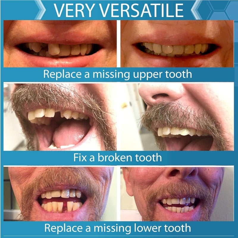 Instant Smile Complete Your Smile Temporary Tooth Replacement Kit Broken or Missing Tooth Repair Kit Bright White Natural and Dark Shades Patented 40 False Teeth - Image 5