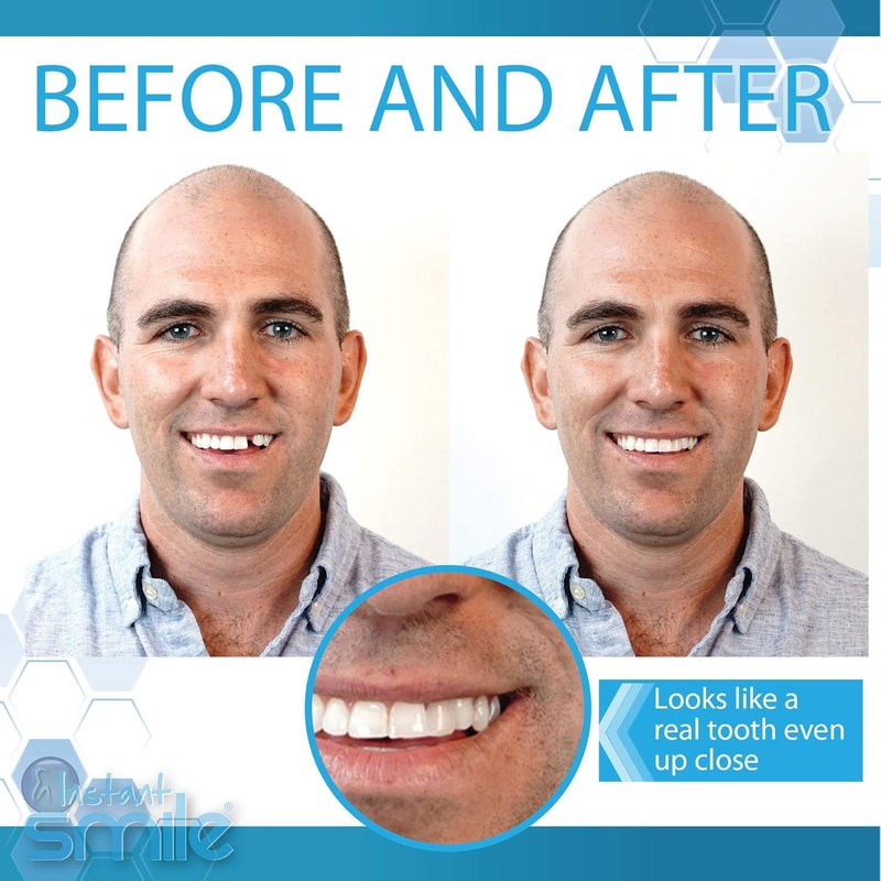 Instant Smile Complete Your Smile Temporary Tooth Replacement Kit Broken or Missing Tooth Repair Kit Bright White Natural and Dark Shades Patented 40 False Teeth - Image 3