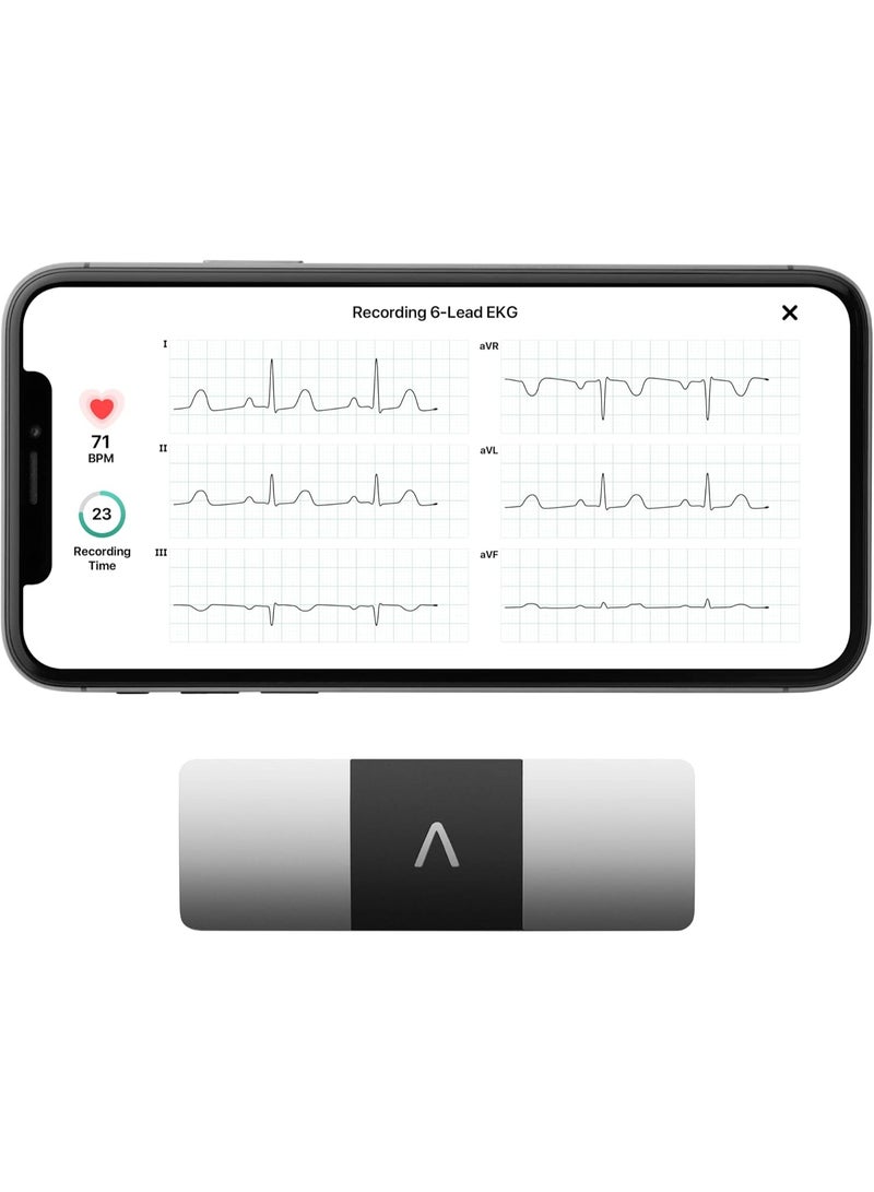 AliveCor KardiaMobile 6-Lead Personal EKG Monitor – Six Views of The Heart – Detects AFib and Irregular Arrhythmias – Instant Results in 30 Seconds – Works with Most Smartphones - Image 1