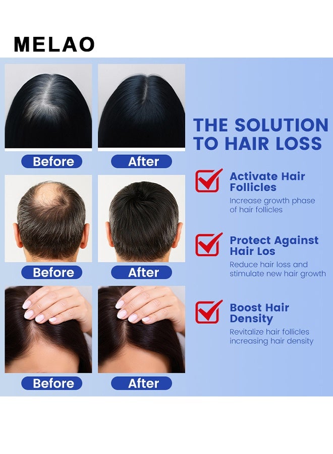 MELAO GHK-CU Copper Peptide Hair Growth Essence Spray, Activates Hair Follicles, Promotes Hair Growth, Strengthens Hair Roots, And Prevents Hair Loss, Suitable For Both Men And Women, 50ml - Image 3