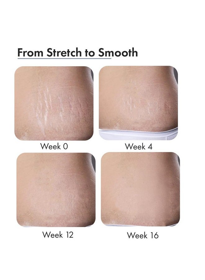 THRIVECO ThriveCo Stretch Marks Expert Serum Cream | For New (red) & Old (white) Stretch Marks Removal & Skin Hydration | Powered by Striover™, Rosehip Oil & Squalane | For Men & Women | 30ml  - Image 5