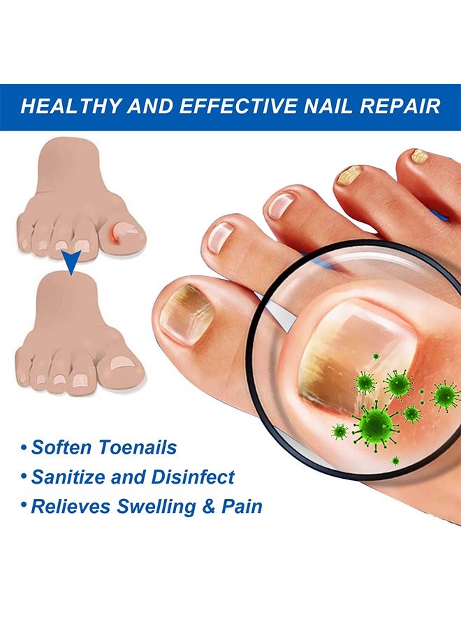 Sefudun Removal Paronychia Oil, Toenail Care Ingrown Toenail Nail Repair Toenail Plus Anti Paronychia Relief Oil Nail Renewal Liquid For Damaged And Discoloration Nail Swelling And Pain Removal Oil, 30ML - Image 5