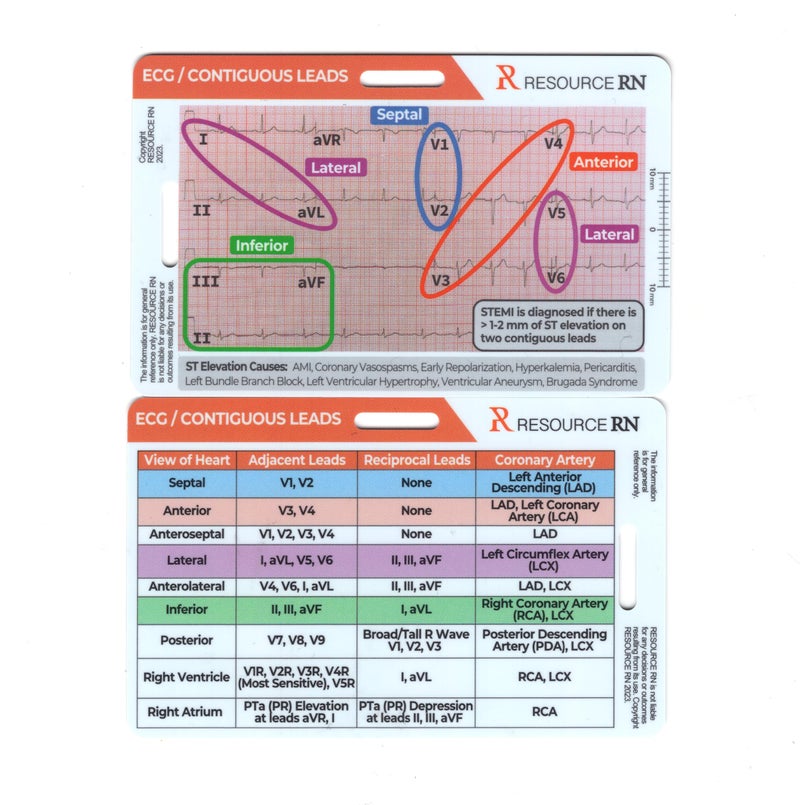 Resource RN EKG STEMI Analysis Badge Card for Rapid Interpretation â€“ Compatible for Both Horizontal & Vertical Layout - Image 1