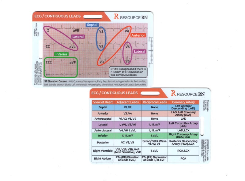Resource RN EKG STEMI Analysis Badge Card for Rapid Interpretation â€“ Compatible for Both Horizontal & Vertical Layout - Image 2