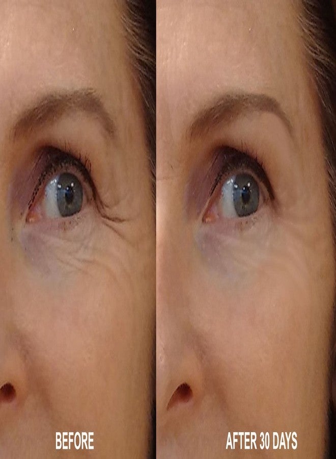 DNA Code®-No Needle Alternative-Pure Argireline Peptides Wrinkle Reduce Serum+ Matrixyl 3000+Hyaluronic Acid - Image 3