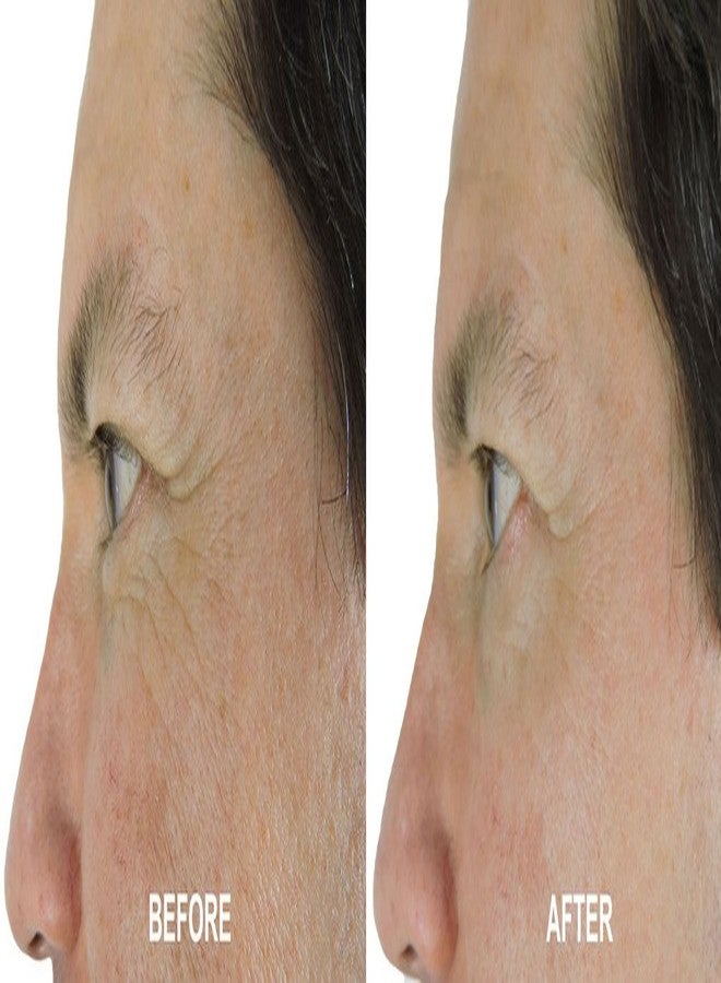 DNA Code®-No Needle Alternative-Pure Argireline Peptides Wrinkle Reduce Serum+ Matrixyl 3000+Hyaluronic Acid - Image 4