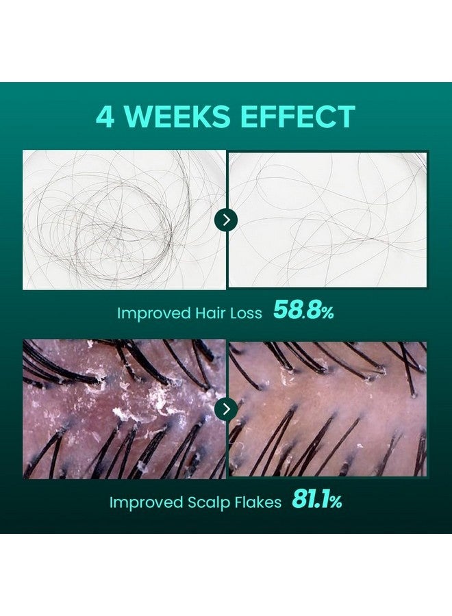 ViveLab Revive Therapy Hair Scalp Enhancing Foam by ViveLab - Nighttime Care for Scalp, Vegan Formula 3.38 oz - Image 3