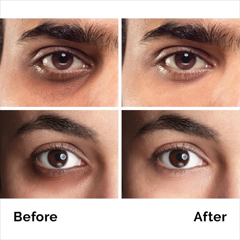 PURE RESEARCH Caffeine Eye Cream For Anti Aging, Dark Circles, Bags, Puffiness. Great Under Eye Skin + Face Tightening, Eye Lift Treatment For Men & Women 1.7oz - Image 5