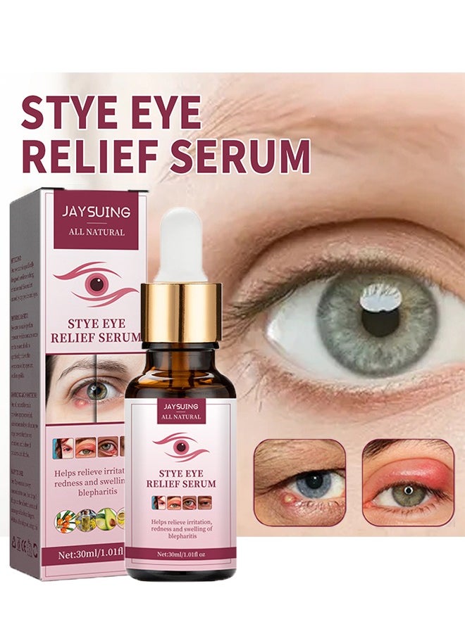 Jaysuing - Stye Eye Relief Serum 30ml, Stye Eye Treatment, Eye Stye Remover, Chalazion Remover, Stye Eye Relief Serum for Styes Chalazion and Blepharitis Treatment, Eye Care, Mild Lash and Eye Cleanser - Image 1