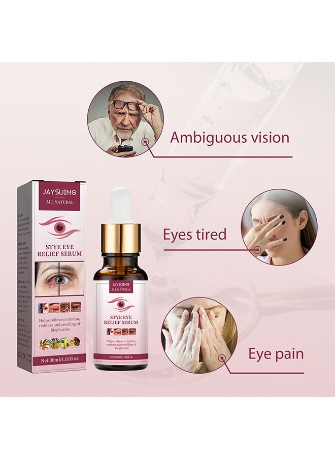 Jaysuing - Stye Eye Relief Serum 30ml, Stye Eye Treatment, Eye Stye Remover, Chalazion Remover, Stye Eye Relief Serum for Styes Chalazion and Blepharitis Treatment, Eye Care, Mild Lash and Eye Cleanser - Image 1