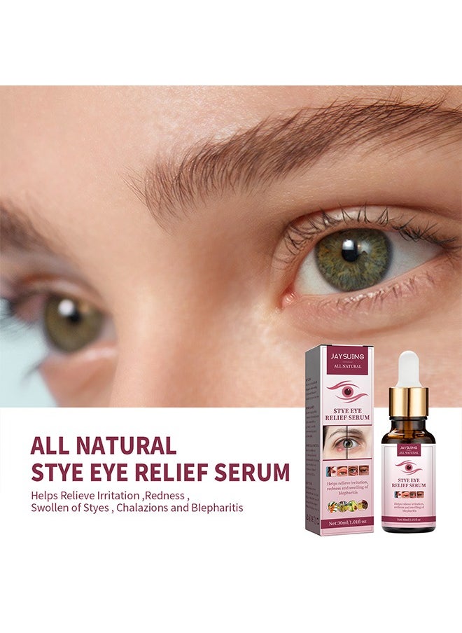 Jaysuing - Stye Eye Relief Serum 30ml, Stye Eye Treatment, Eye Stye Remover, Chalazion Remover, Stye Eye Relief Serum for Styes Chalazion and Blepharitis Treatment, Eye Care, Mild Lash and Eye Cleanser - Image 1