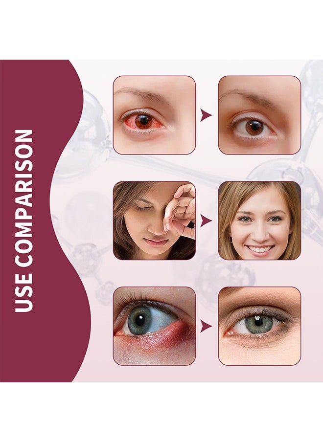 Jaysuing - Stye Eye Relief Serum 30ml, Stye Eye Treatment, Eye Stye Remover, Chalazion Remover, Stye Eye Relief Serum for Styes Chalazion and Blepharitis Treatment, Eye Care, Mild Lash and Eye Cleanser - Image 1
