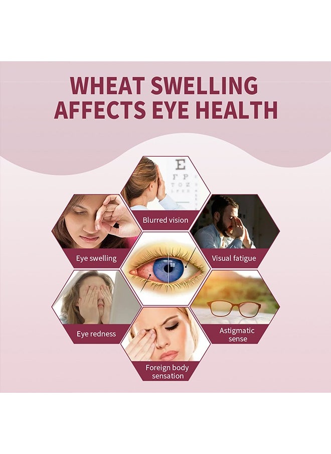 Jaysuing - Stye Eye Relief Serum 30ml, Stye Eye Treatment, Eye Stye Remover, Chalazion Remover, Stye Eye Relief Serum for Styes Chalazion and Blepharitis Treatment, Eye Care, Mild Lash and Eye Cleanser - Image 1
