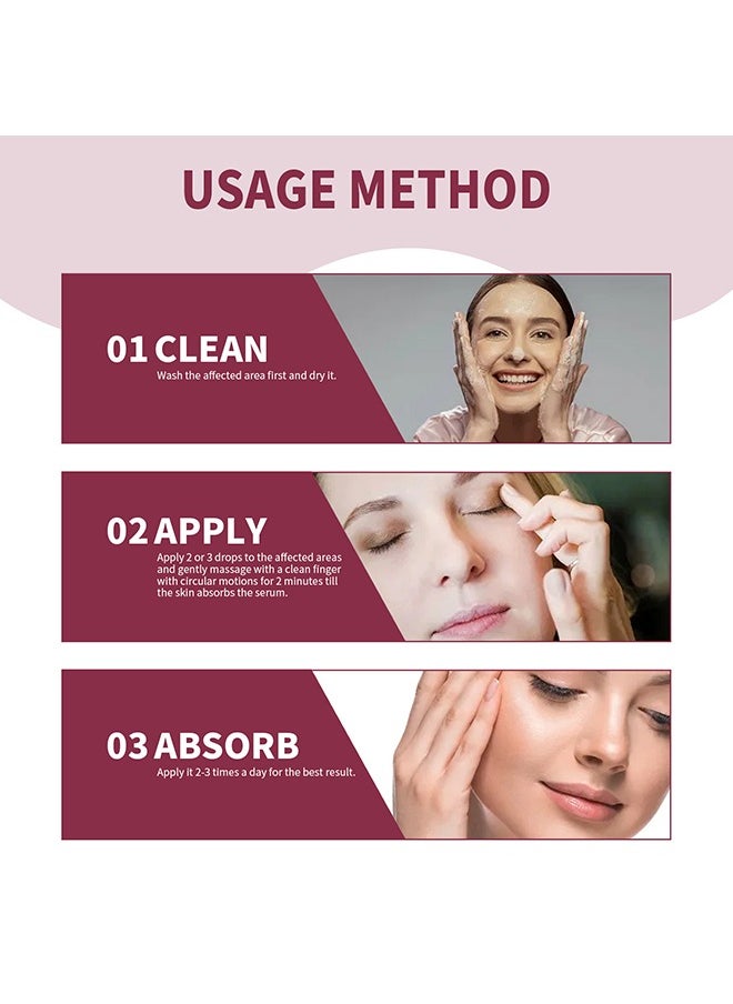 Jaysuing - Stye Eye Relief Serum 30ml, Stye Eye Treatment, Eye Stye Remover, Chalazion Remover, Stye Eye Relief Serum for Styes Chalazion and Blepharitis Treatment, Eye Care, Mild Lash and Eye Cleanser - Image 1
