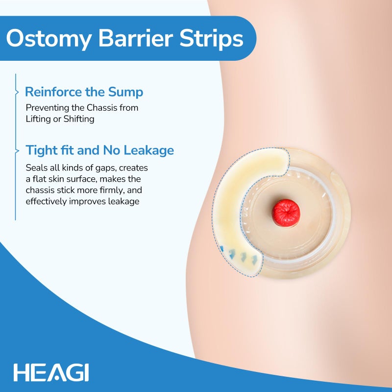 Heagimed 20PCS Ostomy Barrier Strips, Skin-Friendly Hydrocolloid Skin Barrier Strips, Elastic Barrier Strips for Ostomy Bag Ostomy Colostomy Ileostomy Supplies - Image 5
