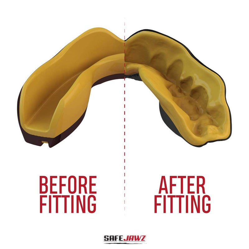 Safejawz Sports Mouthguard Dual Layer Premium Protection Adults And Junior Gum Shield With Case For Boxing  Mma  Rugby  Martial Arts  Judo And All Contact Sports - Image 3