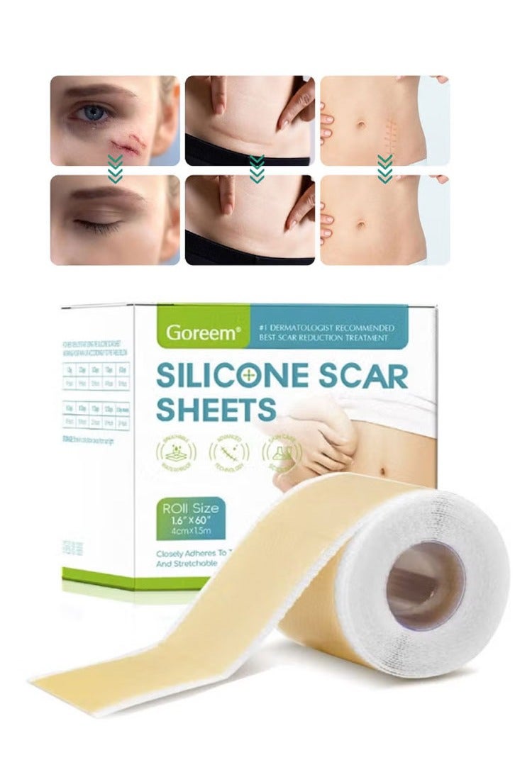 Goreem Silicone Scar Sheets,Silicone Scar Tape,Reusable Efficient Cosmetic Scar Removal Suitable for Caesarean Section Burns Keloid Acne and Other Scar Removal Stickers (4cm x 1.5m) - Image 1