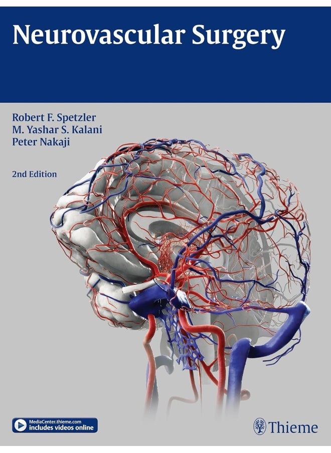 Neurovascular Surgery 