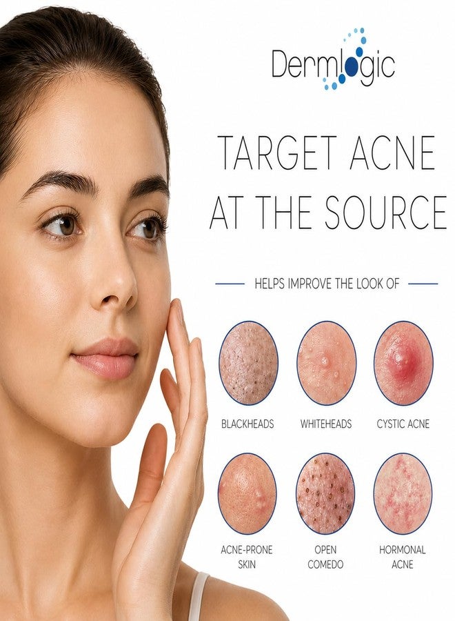 Dermlogic Acne Spot Treatment – Invisible Natural Formula Fights Cystic Acne, Pimples, Breakouts, Whiteheads, Zits & Clogged Pores. Fade Away Dark Spots, Acne Scars, Without Over Drying the Skin. All Skin Types - Image 2