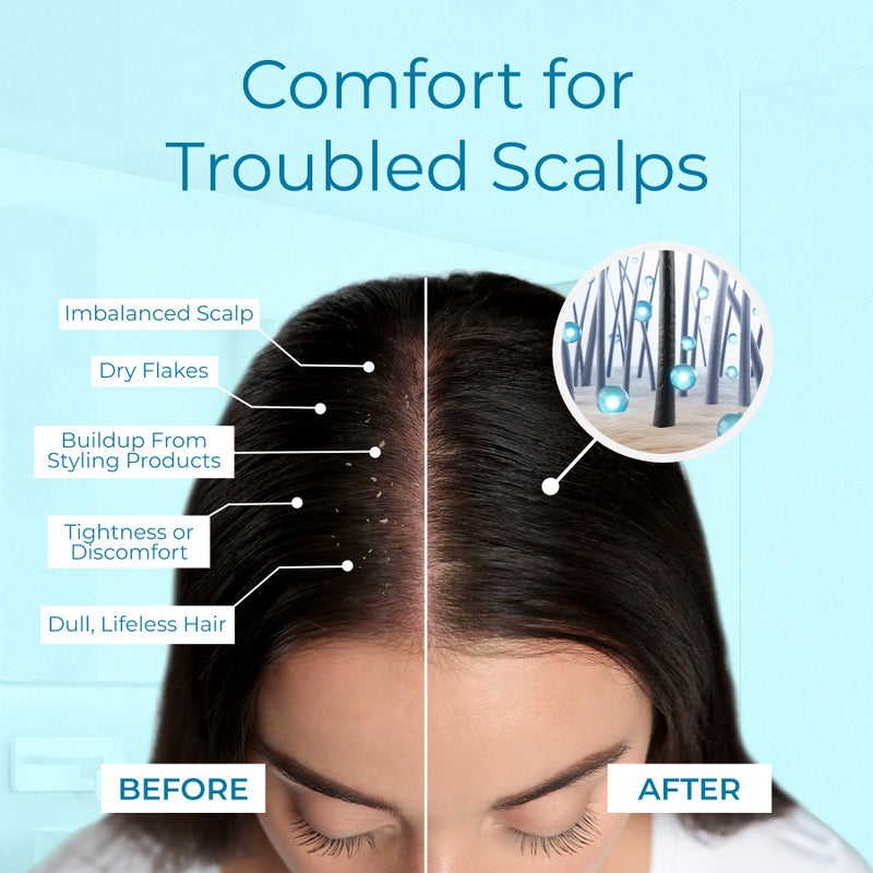 Tree To Tub Dry Scalp Spray - Intensive Scalp Moisturizer for Men & Women - Tea Tree Leave in Scalp Moisturizer for Dry Scalp, Full Spectrum Scalp Spray for Flaky Buildup & Excess Oil, Scalp Care - Image 4
