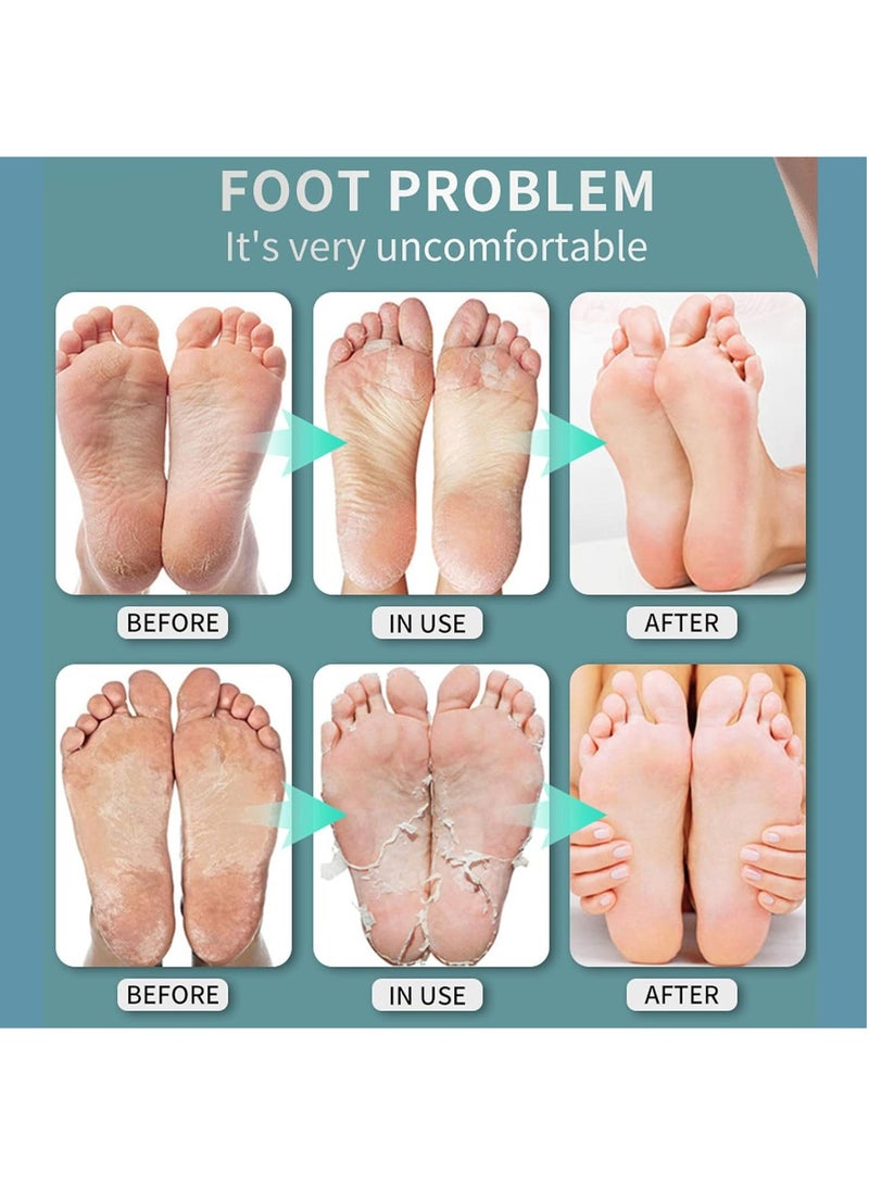 DubaiGallery Foot Spray, Foot Odor and Odor Suppression Beriberi Cream, Can Be Used By Men and Women, Essential for Beriberi 30ml - Image 3