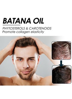 EELHOE Batana Oil for Hair Growth Batana Oil - Batana Oil Organic for Healthy Hair - Repair Damaged Hair, Nourishes Thin Hair Scalp Skin and Loss Hair Growth Fir for All Hair Types, 30 ml  - Image 5