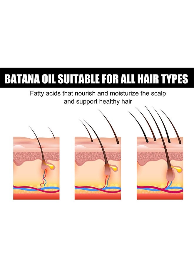 EELHOE - Batana Oil for Hair Growth Batana Oil - Batana Oil Organic for Healthy Hair - Repair Damaged Hair, Nourishes Thin Hair Scalp Skin and Loss Hair Growth Fir for All Hair Types, 30 ml - Image 1