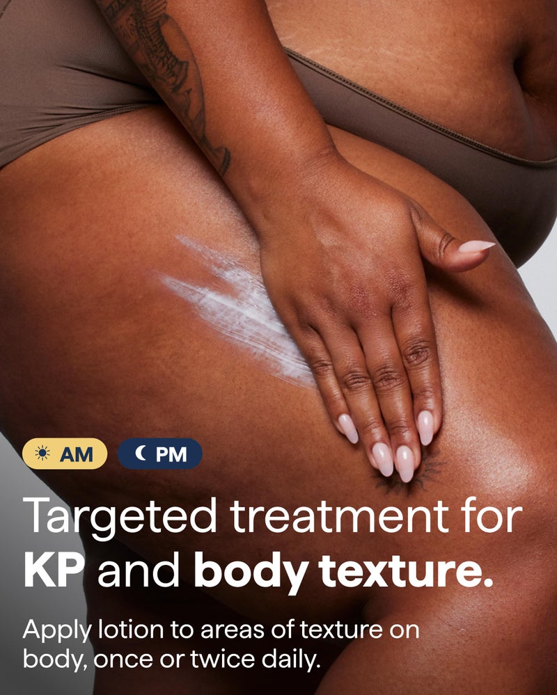 Remedy علاج لنتوءات الجسم - علاج لالتهاب الجريبات الشعرية (KP) والجلد الخشن والمجعد مع اليوريا وحمض اللاكتيك والريتينول - مرطب جسم مهدئ - بواسطة طبيب الجلدية الدكتور شاه - Image 4