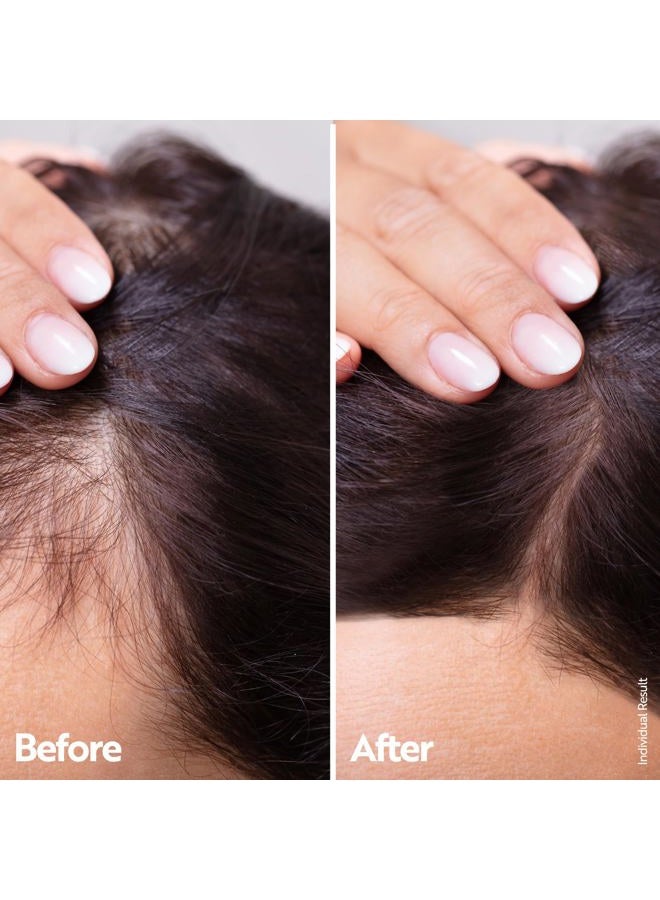 Ahuhu ESSENTIAL ANTI-AGE Elixir With Caffeine & Redensyl (100ml) - Highly Concentrated Scalp Care, Stimulates Hair Growth, Provides Thicker Hair & More Volume, Vegan - Image 3