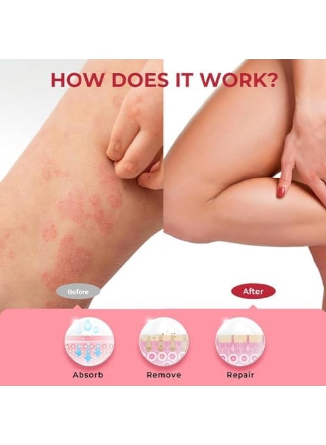 سوميفون كريم تخفيف الإكزيما، 100 جرام كريم للعناية بالبشرة لعلاج الإكزيما، يخفف الحكة والجفاف والقشور، يهدئ البشرة المتهيجة، مثالي لالتهاب الجلد في اليدين والقدمين، يرطب ويعزز حاجز البشرة. - Image 2