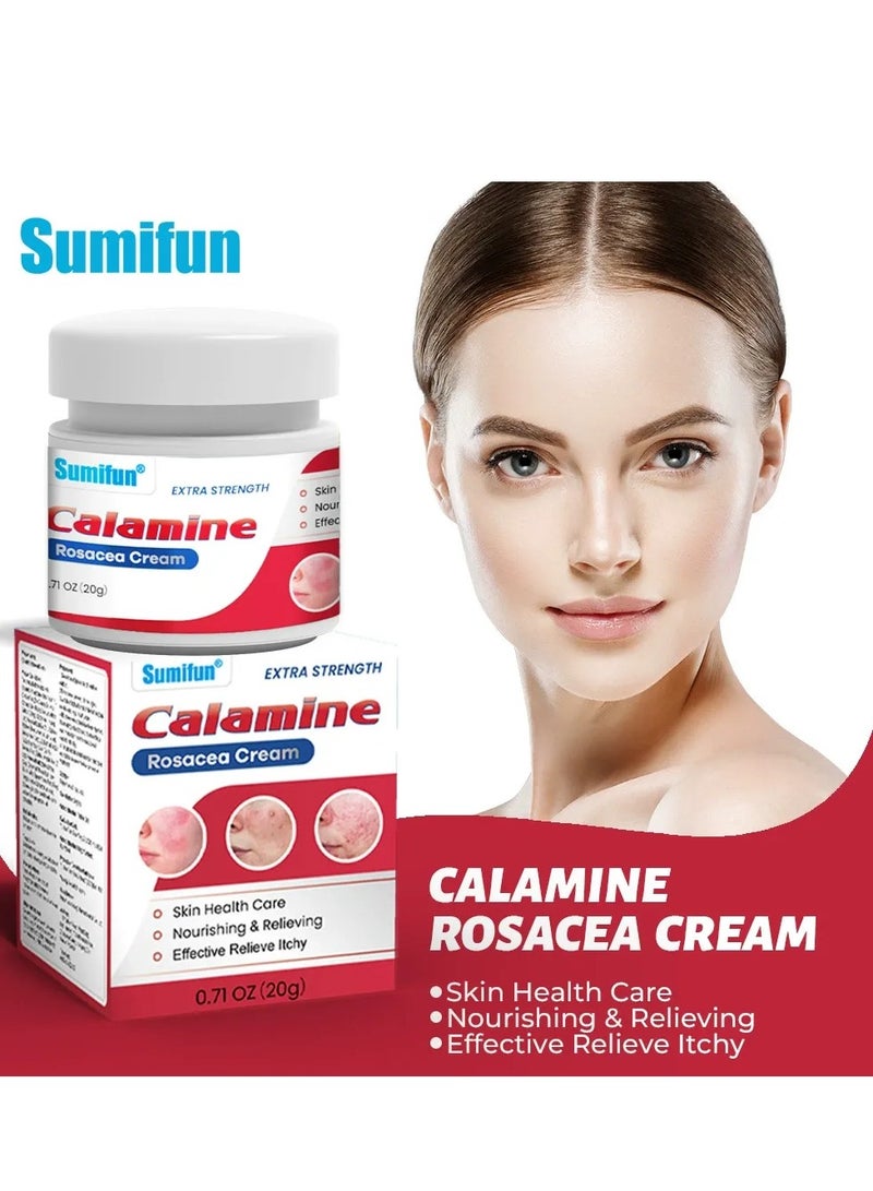 سوميفون كريم تخفيف الإكزيما، 100 جرام كريم للعناية بالبشرة لعلاج الإكزيما، يخفف الحكة والجفاف والقشور، يهدئ البشرة المتهيجة، مثالي لالتهاب الجلد في اليدين والقدمين، يرطب ويعزز حاجز البشرة. - Image 3