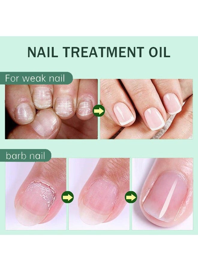 AuQuest Cuticle Care Oil，Nail Cuticle Oil Care with Smooth & Soft Cuticles Brush for Nail Repair Care Treatment Cuticle Oil Pen Nails Moisturizer Manicure Nourish Oil Support Healthy Nail Growth - Image 3