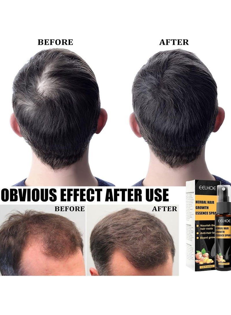 EELHOE Herbal Hair Boost Essence Spray - Regrowth Treatment Anti Hair Loss Serum Hair Growth Essence Spray Micro Needling Roller Set For Bald Head 30ml - Image 3