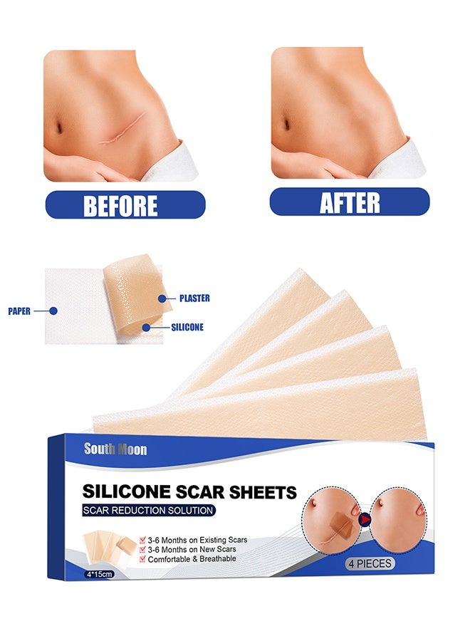 ساوث مون صفائح الندبات المصنوعة من السيليكون ، رقعة إزالة الندبات ، تليين وتسطيح الندبات الناتجة عن الجراحة ، والإصابة ، والحروق ، وتضخم التغذية ، والولادة القيصرية وأكثر من ذلك ، محلول تقليل الندبات 5.9 بوصة × 1.6 بوصة 4 قطع - Image 5